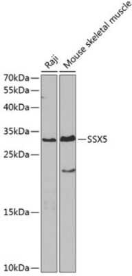 Western Blot: SSX5 AntibodyBSA Free [NBP2-94878]