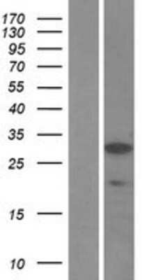 Western Blot: SSX5 Overexpression Lysate [NBL1-16488]