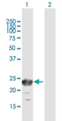 Western Blot: SSX6 Antibody [H00280657-B01P-50ug]