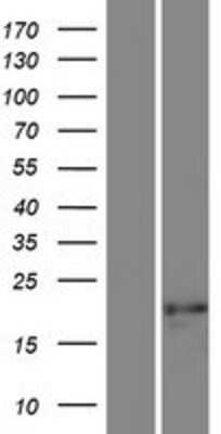 Western Blot: SSX7 Overexpression Lysate [NBP2-05136]