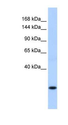 Western Blot: SSX8 Antibody [NBP1-79469]