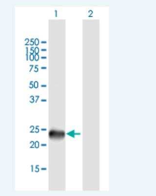 Western Blot: SSX9 Antibody [H00280660-B01P-50ug]