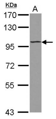 Western Blot: ST18 Antibody [NBP2-20490]