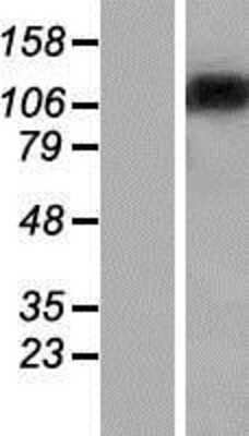 Western Blot: ST18 Overexpression Lysate [NBP2-07295]