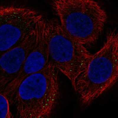 Immunocytochemistry/ Immunofluorescence: ST2/IL-33R Antibody [NBP1-85252]