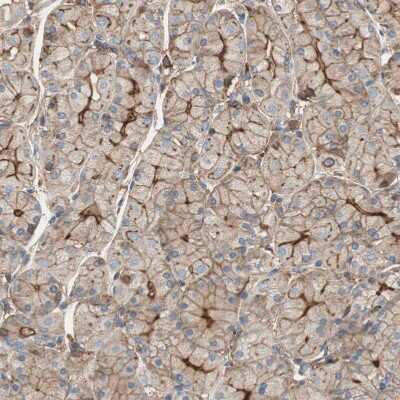 Immunohistochemistry-Paraffin: ST2/IL-33R Antibody [NBP1-85251]