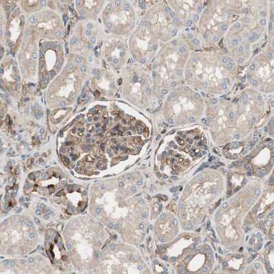 Immunohistochemistry-Paraffin: ST2/IL-33R Antibody [NBP1-85251]