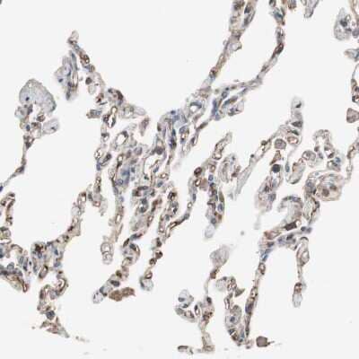 Immunohistochemistry-Paraffin: ST2/IL-33R Antibody [NBP1-85251]