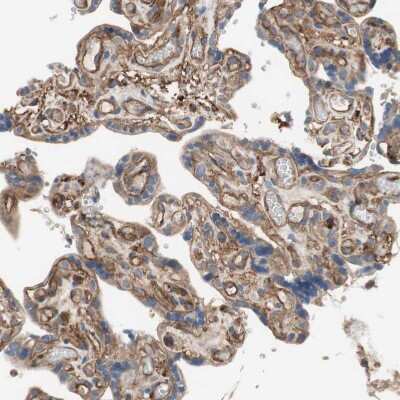 Immunohistochemistry-Paraffin: ST2/IL-33R Antibody [NBP1-85251]