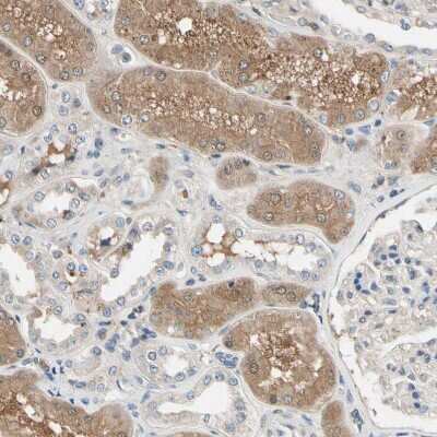 Immunohistochemistry-Paraffin: ST2/IL-33R Antibody [NBP1-85252]