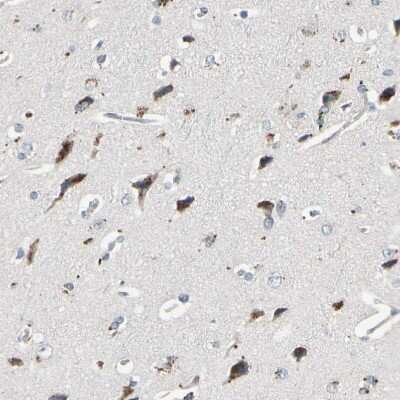 Immunohistochemistry-Paraffin: ST2/IL-33R Antibody [NBP1-85252]