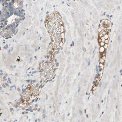 Immunohistochemistry-Paraffin: ST2/IL-33R Antibody [NBP1-85252]