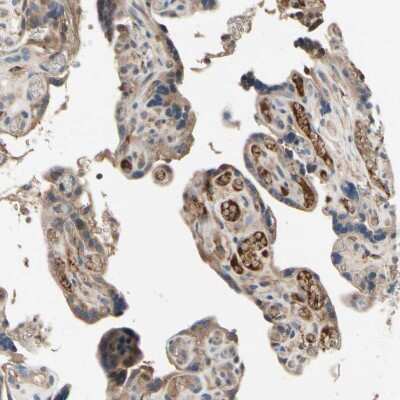 Immunohistochemistry-Paraffin: ST2/IL-33R Antibody [NBP1-85252]