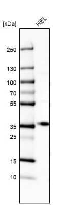 Western Blot: ST2/IL-33R Antibody [NBP1-85251]