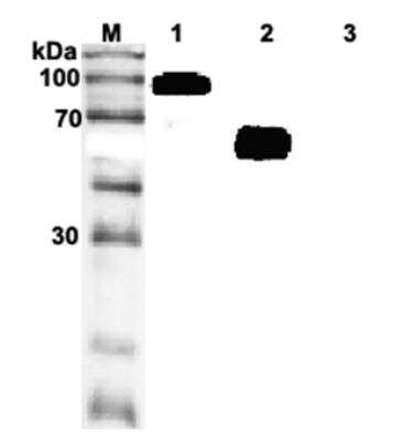 Western Blot: ST2/IL-33R Antibody (ST33868)Azide and BSA Free [NBP2-80040]