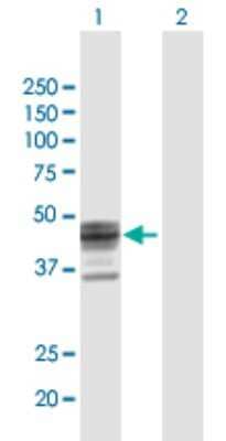 Western Blot: ST3 beta-Gal alpha-2,3-Sialyltransferase 1/ST3GAL1/SIAT4A Antibody [H00006482-B01P]