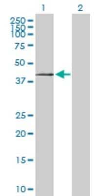 Western Blot: ST3 beta-Gal alpha-2,3-Sialyltransferase 1/ST3GAL1/SIAT4A Antibody [H00006482-D01P]