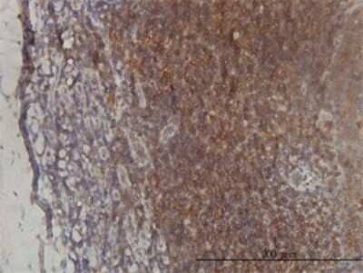 Immunohistochemistry-Paraffin: ST3 beta-Gal alpha-2,3-Sialyltransferase 2/ST3GAL2 Antibody (1E12) [H00006483-M01]