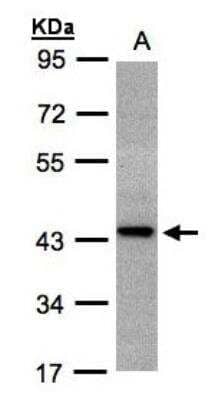 Western Blot: ST3 beta-Gal alpha-2,3-Sialyltransferase 2/ST3GAL2 Antibody [NBP1-32451]