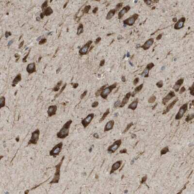 Immunohistochemistry-Paraffin: ST3 beta-Gal alpha-2,3-Sialyltransferase 2/ST3GAL2 Antibody [NBP1-87044]