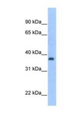 Western Blot: ST3 beta-Gal alpha-2,3-Sialyltransferase 2/ST3GAL2 Antibody [NBP1-69570]