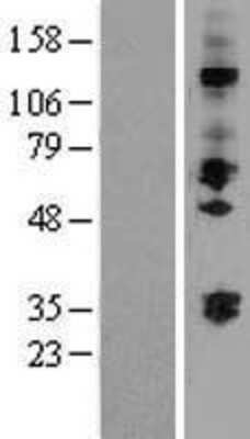 Western Blot: ST3 beta-Gal alpha-2,3-Sialyltransferase 2/ST3GAL2 Overexpression Lysate [NBP2-07558]