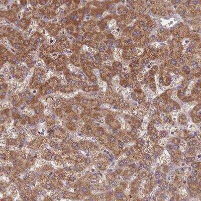 Immunohistochemistry-Paraffin: ST3GAL3 Antibody [NBP2-13389]