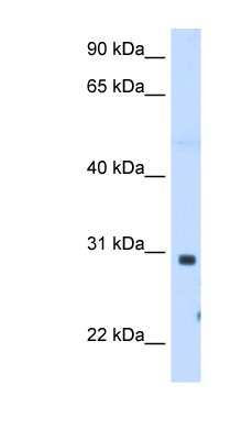 Western Blot: ST3GAL3 Antibody [NBP1-60067]