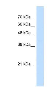 Western Blot: ST3GAL3 Antibody [NBP1-62554]