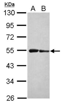 Western Blot: ST3GAL3 Antibody [NBP2-20491]