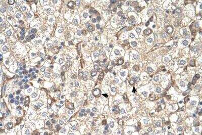 Immunohistochemistry: ST3GAL4 Antibody [NBP1-69565]