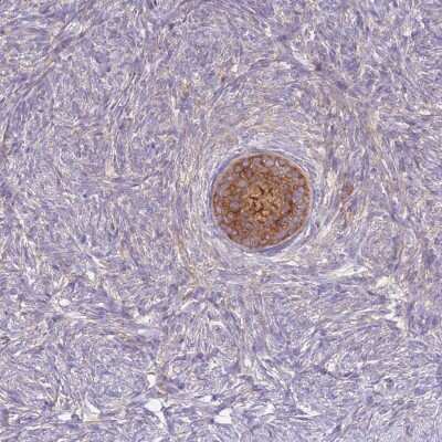 Immunohistochemistry-Paraffin: ST3GAL4 Antibody [NBP2-13390]