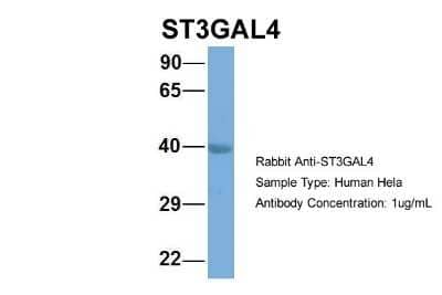 Western Blot: ST3GAL4 Antibody [NBP1-62481]