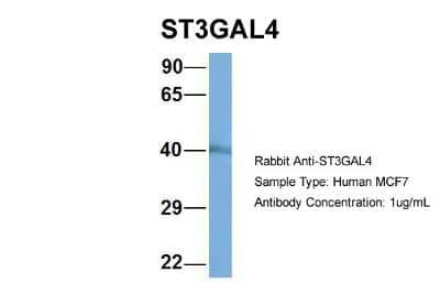 Western Blot: ST3GAL4 Antibody [NBP1-62481]