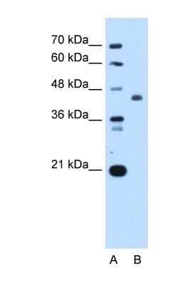 Western Blot: ST3GAL4 Antibody [NBP1-69565]