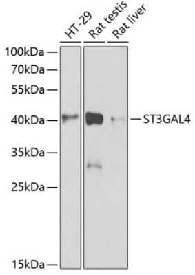 Western Blot: ST3GAL4 AntibodyBSA Free [NBP2-93783]