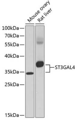 Western Blot: ST3GAL4 AntibodyBSA Free [NBP2-95141]