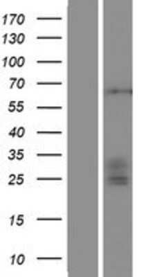 Western Blot: ST3GAL4 Overexpression Lysate [NBP2-07648]