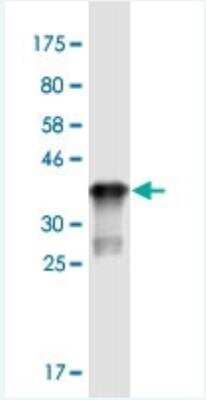 Western Blot: ST3GAL5 Antibody (8B4) [H00008869-M04-100ug]