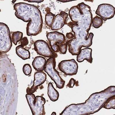 Immunohistochemistry: ST3GAL5 Antibody [NBP2-32612]