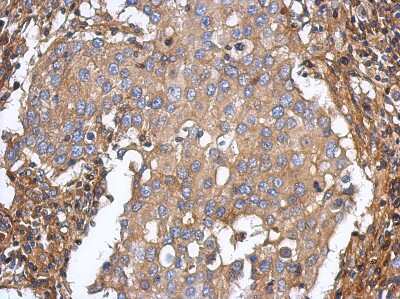 Immunohistochemistry-Paraffin: ST3GAL5 Antibody [NBP2-20492]