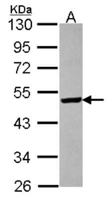 Western Blot: ST3GAL5 Antibody [NBP2-20492]