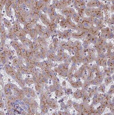 Immunohistochemistry-Paraffin: ST3GAL6 Antibody [NBP1-92446]