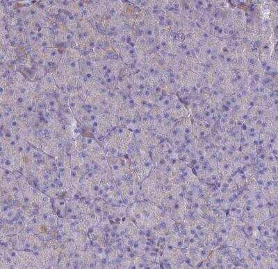 Immunohistochemistry-Paraffin: ST3GAL6 Antibody [NBP1-92446]