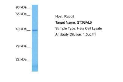 Western Blot: ST3GAL6 Antibody [NBP2-85830]