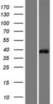 Western Blot: ST3GAL6 Overexpression Lysate [NBP2-07666]