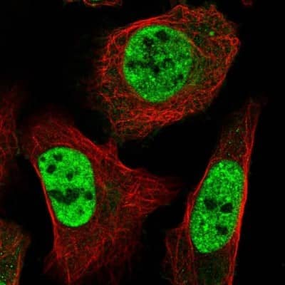 Immunocytochemistry/ Immunofluorescence: ST5 Antibody [NBP2-13391]