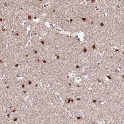 Immunohistochemistry-Paraffin: ST5 Antibody [NBP2-13391]