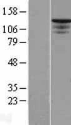 Western Blot: ST5 Overexpression Lysate [NBP2-09816]