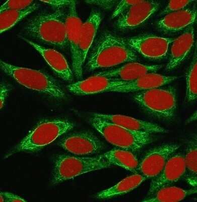 Immunocytochemistry/ Immunofluorescence: ST6 Gal Sialyltransferase 1/ST6GAL1/CD75 Antibody (LN-1) - Azide and BSA Free [NBP2-47890]